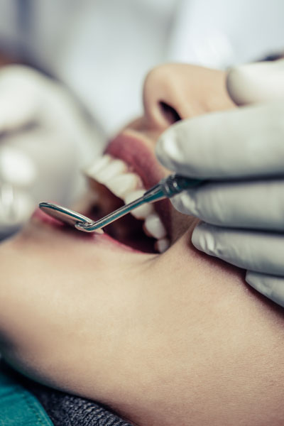 Dental Procedures